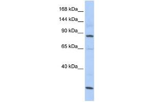 WB Suggested Anti-MSH5 Antibody Titration:  0.