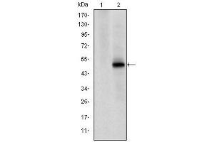 Image no. 3 for anti-Cyclin-Dependent Kinase 9 (CDK9) antibody (ABIN1106653)