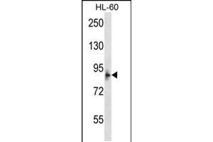 Image no. 1 for anti-Microcephalin 1 (MCPH1) (AA 104-133), (N-Term) antibody (ABIN5531653)