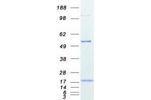 Image no. 1 for Profilin 2 (PFN2) (Transcript Variant 1) protein (Myc-DYKDDDDK Tag) (ABIN2729685)