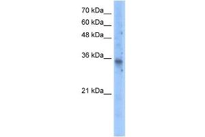 Image no. 1 for anti-Solute Carrier Family 25 (Mitochondrial Carrier, Graves Disease Autoantigen), Member 16 (SLC25A16) (N-Term) antibody (ABIN630321)