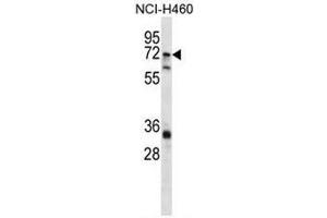 Image no. 1 for anti-ST6 (Alpha-N-Acetyl-Neuraminyl-2,3-beta-Galactosyl-1,3)-N-Acetylgalactosaminide alpha-2,6-Sialyltransferase 1 (ST6GALNAC1) (AA 35-65), (N-Term) antibody (ABIN954961)