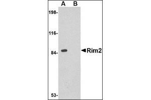 Image no. 2 for anti-Regulating Synaptic Membrane Exocytosis 2 (RIMS2) (Center) antibody (ABIN500608)