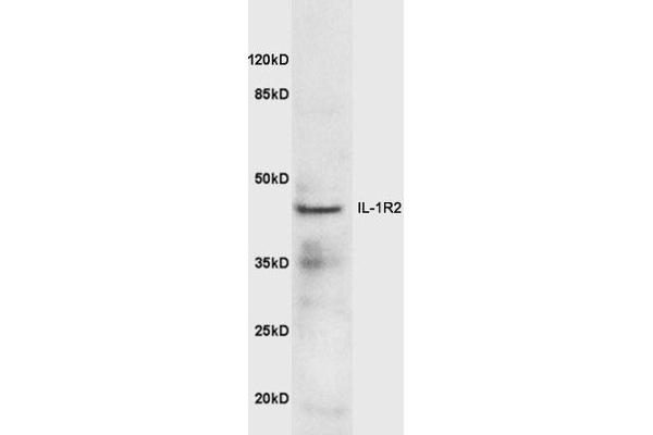 IL1R2 anticorps  (AA 301-398)