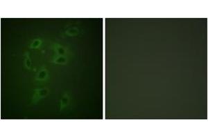 Immunofluorescence analysis of HepG2 cells, using CBL (Phospho-Tyr700) Antibody.