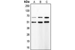 Image no. 3 for anti-Matrix Metallopeptidase 8 (Neutrophil Collagenase) (MMP8) (C-Term) antibody (ABIN2704998)