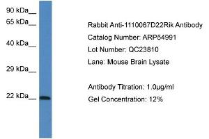 Image no. 1 for anti-Galectin-Related Protein (GRP) (Middle Region) antibody (ABIN2774094)