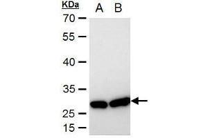 Image no. 4 for anti-Heat Shock 27kDa Protein 1 (HSPB1) (Center) antibody (ABIN2854951)