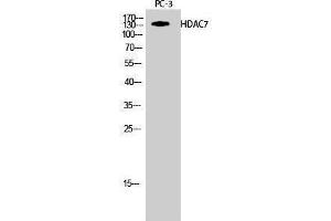 Image no. 1 for anti-Histone Deacetylase 7 (HDAC7) (Tyr721) antibody (ABIN3184990)