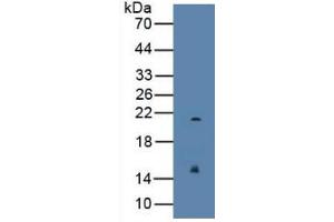 Image no. 4 for Regenerating Islet Derived Protein 3 gamma (REG3g) ELISA Kit (ABIN6720589)