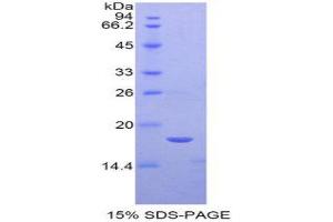 Image no. 1 for Sema Domain, Immunoglobulin Domain (Ig), Short Basic Domain, Secreted, (Semaphorin) 3A (SEMA3A) (AA 31-150) protein (His tag) (ABIN1877372)