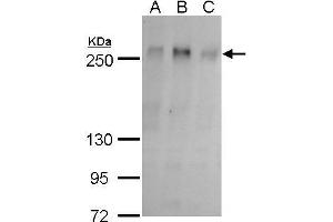 WB Image ZO-1 antibody detects ZO-1 protein by western blot analysis.