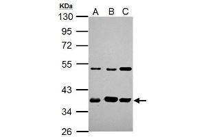 Image no. 4 for anti-Aryl Hydrocarbon Receptor Interacting Protein (AIP) (Center) antibody (ABIN2856771)