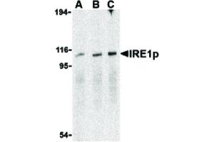 Image no. 1 for anti-Endoplasmic Reticulum To Nucleus Signaling 1 (ERN1) (C-Term) antibody (ABIN6657002)