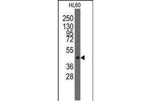 Image no. 1 for anti-LIM Homeobox Transcription Factor 1, alpha (LMX1A) (AA 130-159) antibody (ABIN5531416)