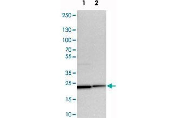 anti-Yip1 Interacting Factor Homolog A (YIF1A) antibody