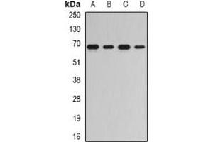 Image no. 3 for anti-RNA Guanylyltransferase and 5'-Phosphatase (RNGTT) antibody (ABIN2966996)