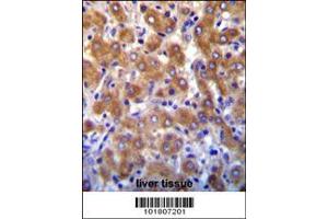 Image no. 2 for anti-ATP-Binding Cassette, Sub-Family B (MDR/TAP), Member 10 (ABCB10) (AA 1-27), (N-Term) antibody (ABIN652180)