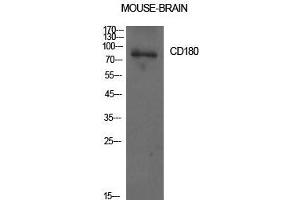 Image no. 2 for anti-CD180 Molecule (CD180) (Internal Region) antibody (ABIN3181467)