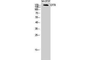 Image no. 1 for anti-Cystic Fibrosis Transmembrane Conductance Regulator (ATP-Binding Cassette Sub-Family C, Member 7) (CFTR) (Ser246) antibody (ABIN3183888)