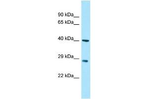 Image no. 1 for anti-Myozenin 3 (MYOZ3) (C-Term) antibody (ABIN2790425)