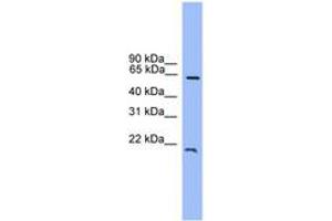 Image no. 1 for anti-Dachshund 1 (DACH1) (C-Term) antibody (ABIN6745356)