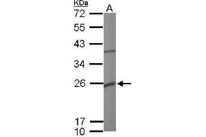 Image no. 2 for anti-Potassium Large Conductance Calcium-Activated Channel, Subfamily M, beta Member 1 (KCNMB1) (Center) antibody (ABIN2856153)