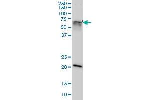 anti-GATA Zinc Finger Domain Containing 2A (GATAD2A) (AA 26-134) antibody
