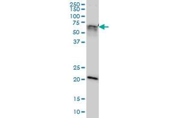 anti-GATA Zinc Finger Domain Containing 2A (GATAD2A) (AA 26-134) antibody