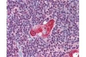 Image no. 1 for anti-T-Cell Leukemia Homeobox 1 (TLX1) (AA 300-330) antibody (ABIN2470149)