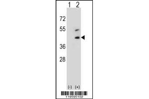 Western Blotting (WB) image for anti-Decorin (DCN) antibody (ABIN2158495)