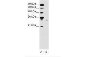Image no. 2 for anti-Solute Carrier Family 22 (Organic Cation Transporter), Member 7 (SLC22A7) (C-Term) antibody (ABIN6736645)