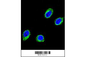 Immunofluorescence (IF) image for anti-Coiled-Coil alpha-Helical Rod Protein 1 (CCHCR1) antibody (ABIN2158089)