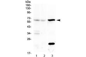 Image no. 1 for anti-Interleukin 23 Receptor (IL23R) antibody (ABIN5647308)