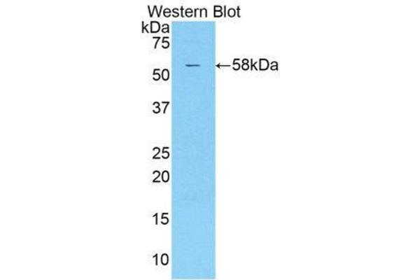 anti-Killer Cell Immunoglobulin-Like Receptor 2DS2 (KIR2DS2) (AA 22-304) antibody