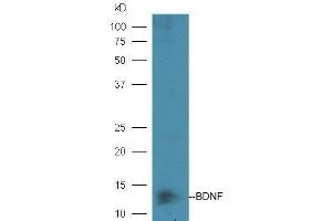 Image no. 2 for anti-Brain-Derived Neurotrophic Factor (BDNF) (AA 151-247) antibody (ABIN1387788)