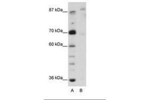 Image no. 1 for anti-GLIS Family Zinc Finger 3 (GLIS3) (N-Term) antibody (ABIN203253)