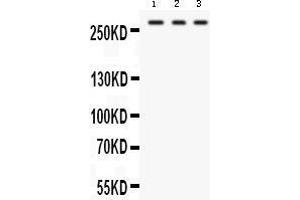 Image no. 1 for anti-Fatty Acid Synthase (FASN) (AA 1-226) antibody (ABIN3044520)