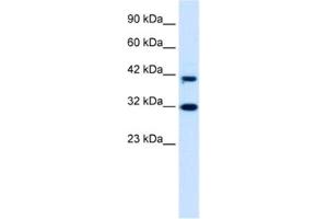 Image no. 1 for anti-D4, Zinc and Double PHD Fingers Family 1 (DPF1) antibody (ABIN2460940)