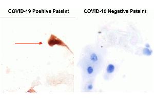 Immunohistochemistry (IHC) image for anti-SARS-CoV-2 Spike (C-Term) antibody (ABIN1030641)