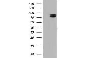 Image no. 3 for anti-Tectonic Family Member 2 (TCTN2) antibody (ABIN2733403)