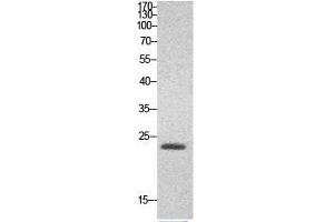 Image no. 8 for anti-High Mobility Group Box 1 (HMGB1) (Internal Region) antibody (ABIN3181047)
