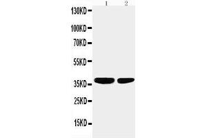 Image no. 2 for anti-Protein Phosphatase 2, Catalytic Subunit, alpha Isozyme (PPP2CA) (AA 6-20), (N-Term) antibody (ABIN3044492)