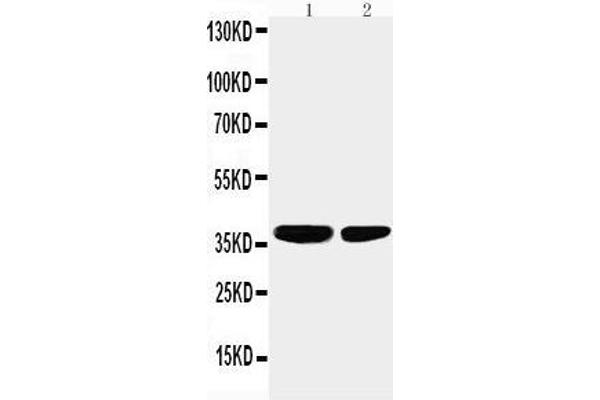 PPP2CA antibody  (N-Term)