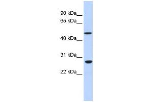 Image no. 1 for anti-Zinc Finger Protein 556 (ZNF556) antibody (ABIN2458203)