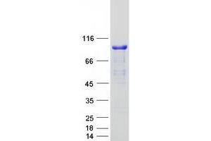 PALMD Protein (Myc-DYKDDDDK Tag)