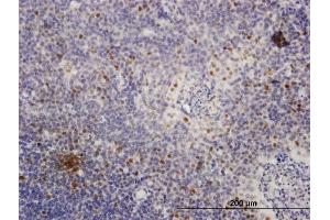 Image no. 4 for anti-Minichromosome Maintenance Deficient 4 (MCM4) (AA 1-863) antibody (ABIN517776)