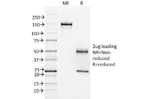 Image no. 4 for anti-Forkhead Box A1 (FOXA1) (AA 372-472) antibody (ABIN6939655)