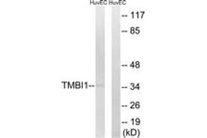 Image no. 1 for anti-Transmembrane BAX Inhibitor Motif Containing 1 (TMBIM1) (AA 251-300) antibody (ABIN1535424)