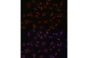 ACAT1 antibody  (AA 1-145)